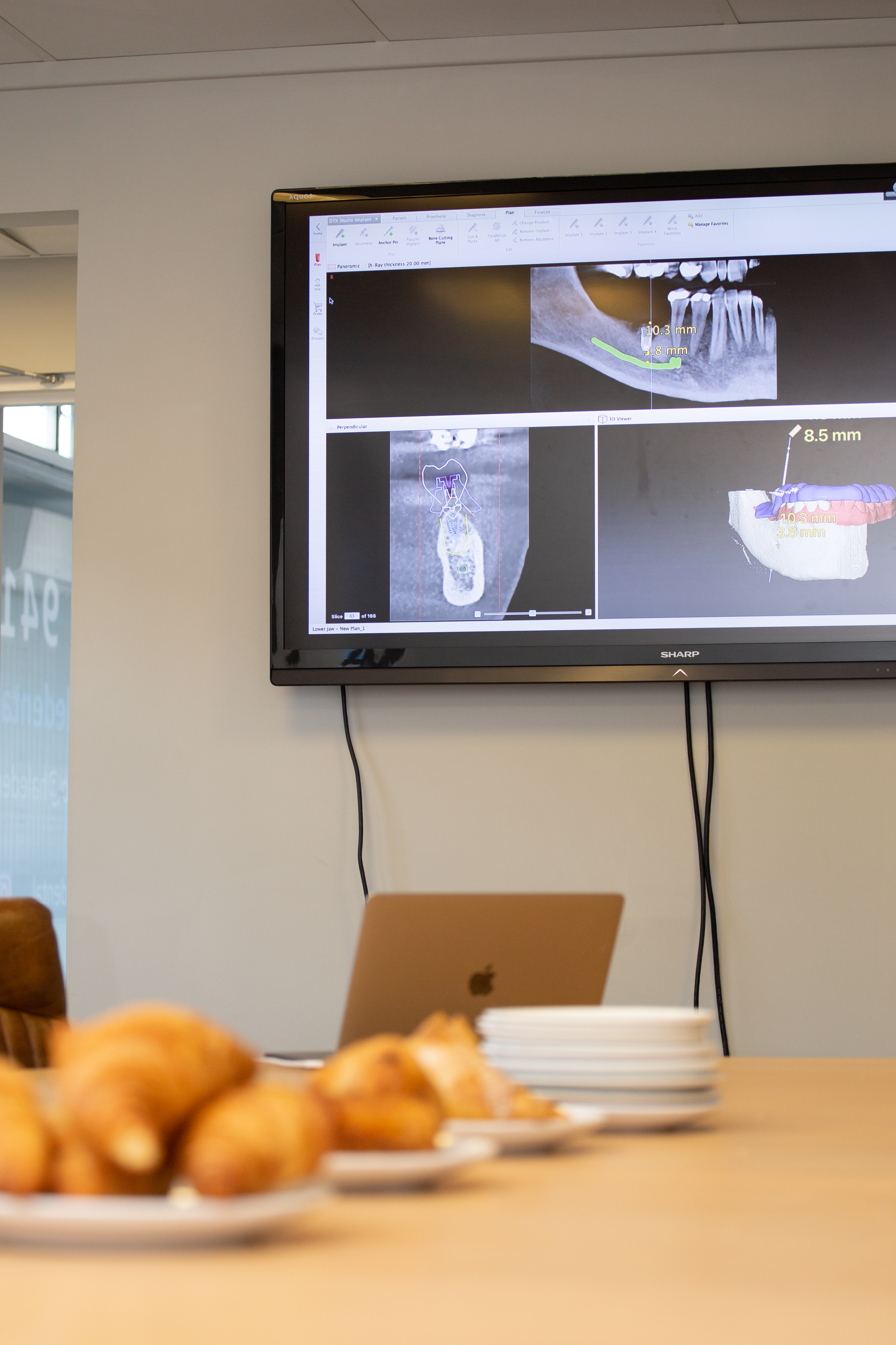CADE Implant Year Course